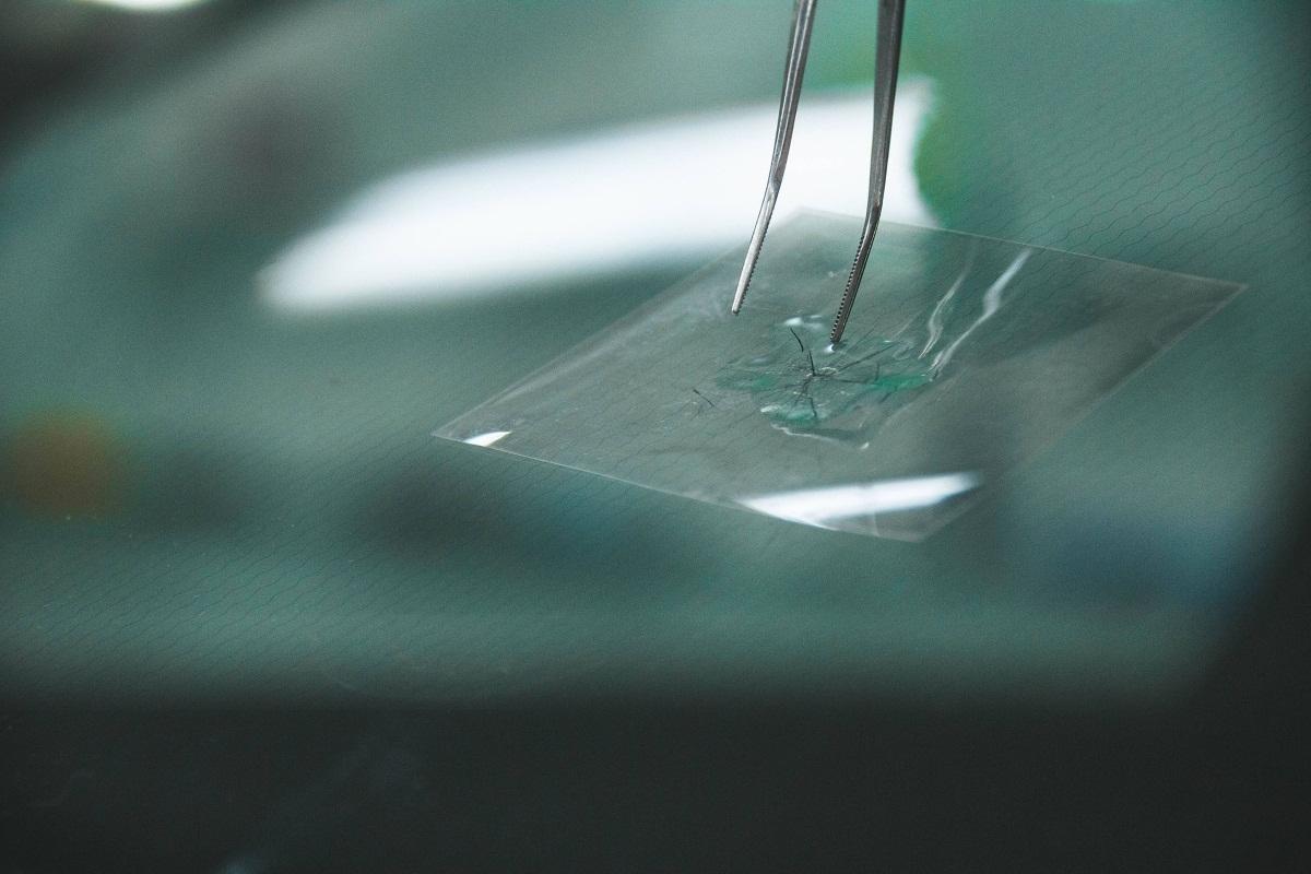 Hoe sneller we een kleine beschadiging laten repareren, hoe gemakkelijker deze te herstellen is.